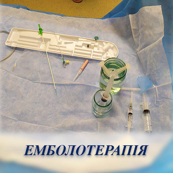 Емболотерапія