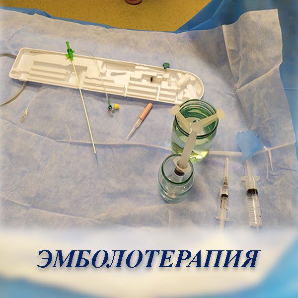 Эмболотерапия