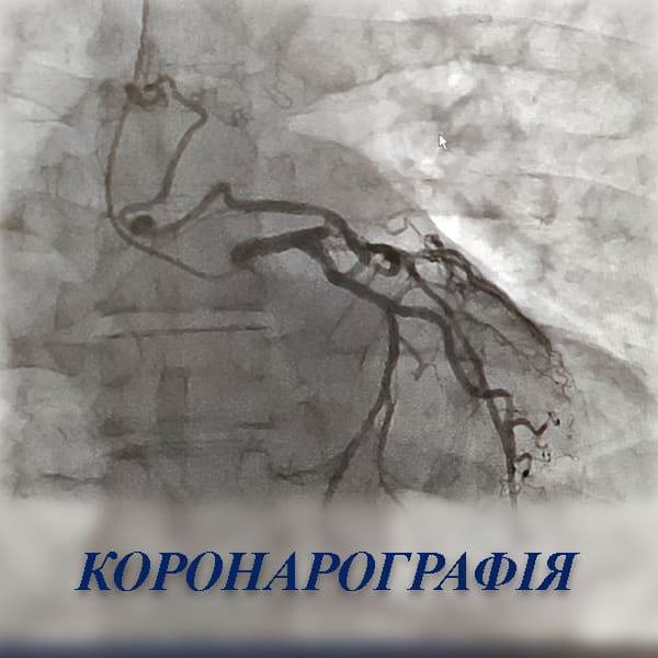 Коронарографія