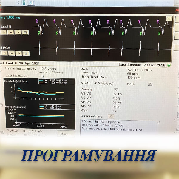 Програмування кардиостимуляторів