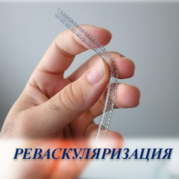 Эндоваскулярна реваскуляризация