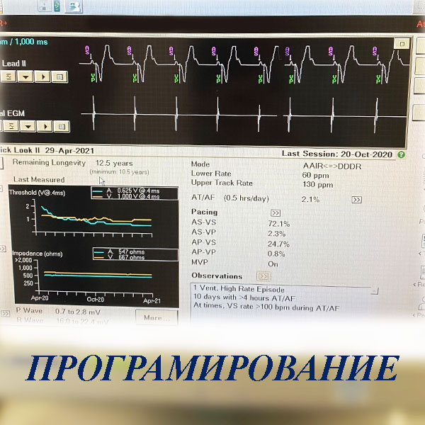 Програмирование кардиостимулятора